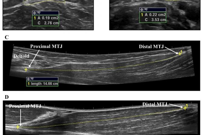 Ultrasound imaging of male and female biceps 