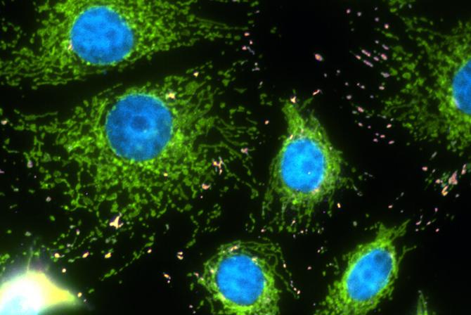 Image de cellules de cancer du sein créée par un microscope à épifluorescence.
