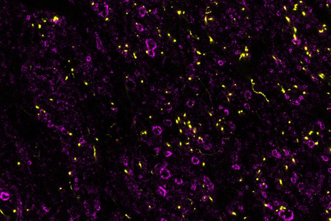 Images d’axones dopaminergiques et myélinisés de faisceau médian du cerveau antérieur d’un rat produite par un microscope confocal C2 de Nikon.