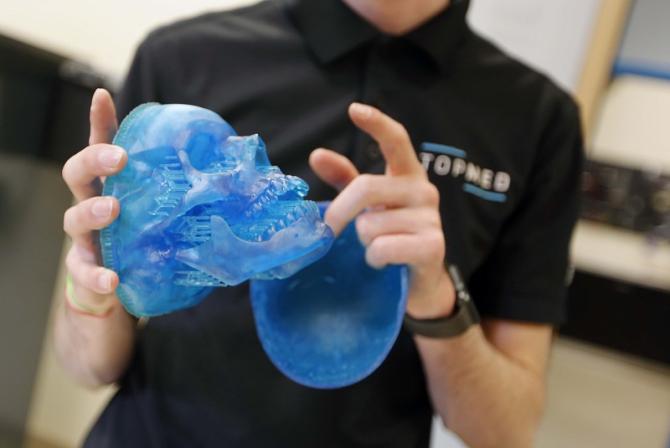 Une personne tient une pièce imprimée en 3D ayant la forme d'un crâne humain.