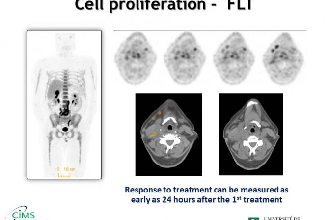 Cell proliferation-FLT. Response to treatment can be measured as early as 24 hours after the 1st treatment.